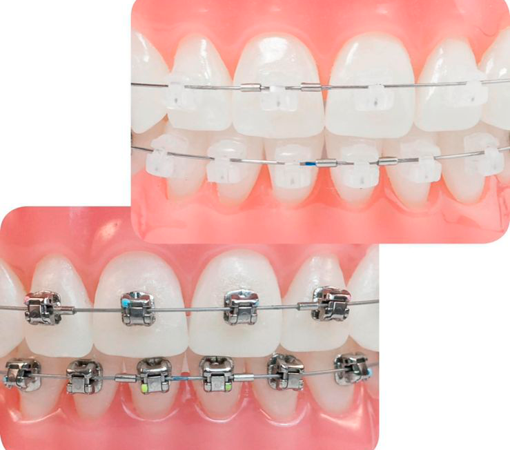 Ortodoncia de alta especialidad