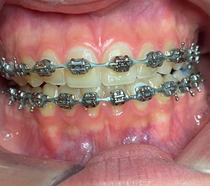 Ortodoncia de alta especialidad