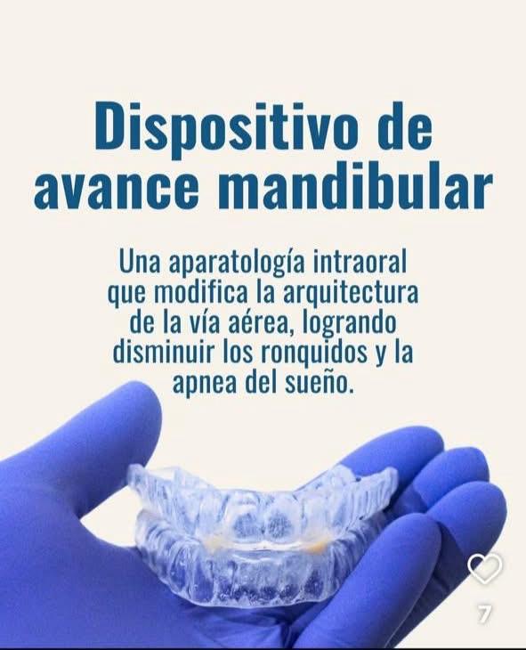 Dispositivo de Avance Mandibular